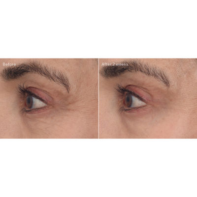 Murad Retinal Resculpt Eye Lift Treatment Hamilton Place