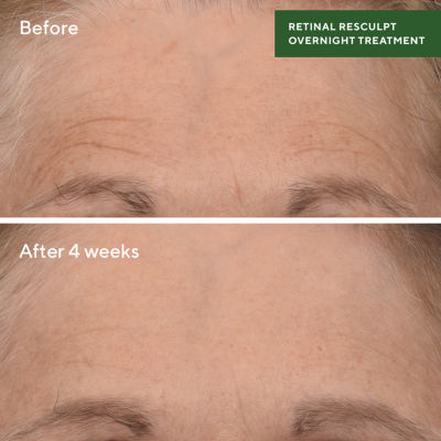 Murad Retinal Resculpting Overnight Treatment Facial Treatments