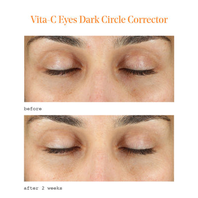 Murad Vita C Dark Circle Corrector Eye Cream