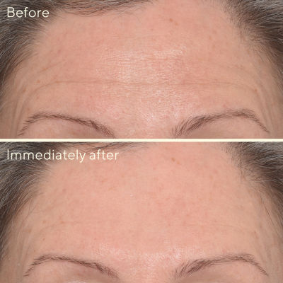 Murad Targeted Wrinkle Corrector