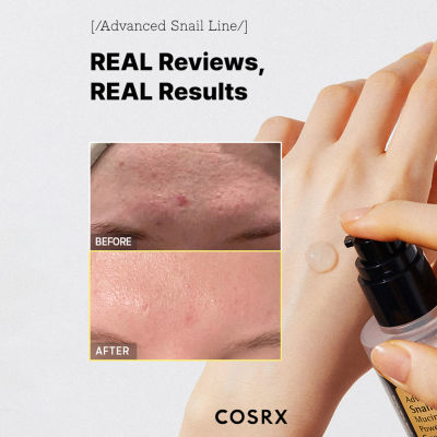 Cosrx Advanced Snail 96 Mucin Power Essence Face Treatment