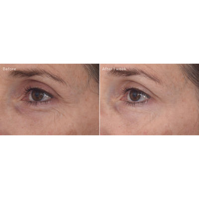 Murad Retinal Resculpt Eye Lift Treatment