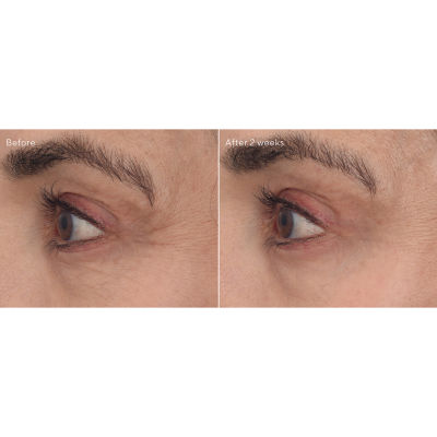 Murad Retinal Resculpt Eye Lift Treatment