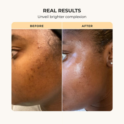 Buttah Skin Cocoshea Transforming Skin Kit