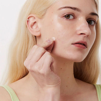 I Dew Care Timeout Blemish Patch Original