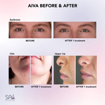 Spa Sciences Aiva Facial Hair Remover