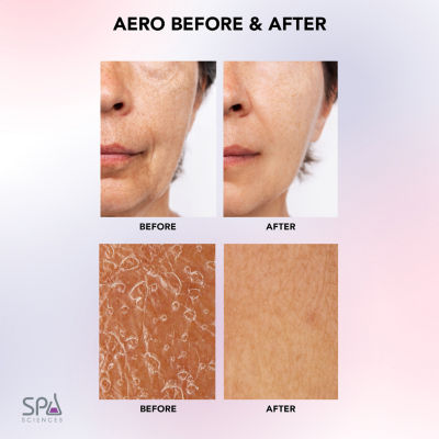 Spa Sciences Aero Advanced Skincare Infusion System