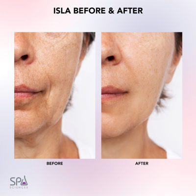 Spa Sciences Isla Sonic Face Body Roller Contouring System