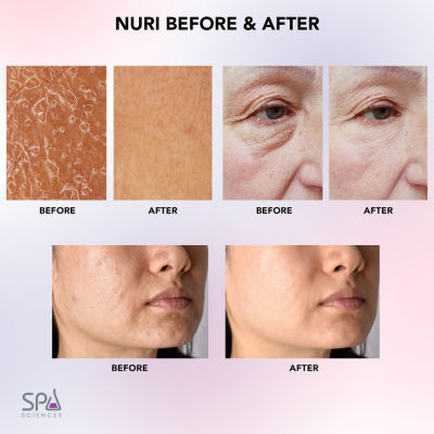 Spa Sciences Nuri Led Thermal Smart Facial Skincare Mask Infuser