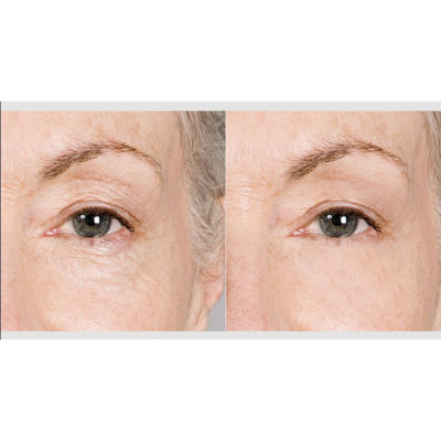 Prospera Pink Ceramic Hair Straightener & Mini Body