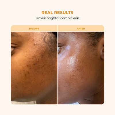 Buttah Skin Vitamin C Serum