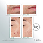 Murad Outsmart Acne™ Clarifying Treatment
