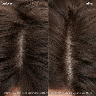 Biolage Scalp Sync Universal Conditioner - 33.8 oz.