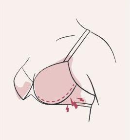 Poking Underwires